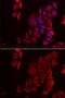 Phosphoribosylaminoimidazole Carboxylase And Phosphoribosylaminoimidazolesuccinocarboxamide Synthase antibody, GTX33382, GeneTex, Immunofluorescence image 