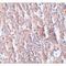 Solute Carrier Family 39 Member 5 antibody, LS-C115936, Lifespan Biosciences, Immunohistochemistry paraffin image 