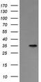 Asialoglycoprotein Receptor 2 antibody, TA505266AM, Origene, Western Blot image 