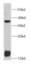 Protein Kinase AMP-Activated Non-Catalytic Subunit Beta 1 antibody, FNab00377, FineTest, Western Blot image 
