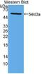 Lysophosphatidylcholine Acyltransferase 1 antibody, abx130693, Abbexa, Western Blot image 