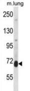 Protein Kinase C Delta antibody, abx028187, Abbexa, Western Blot image 