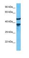 Aminoacylase 3 antibody, orb326433, Biorbyt, Western Blot image 