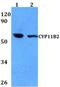 Cytochrome P450 Family 11 Subfamily B Member 2 antibody, GTX66783, GeneTex, Western Blot image 