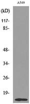 Histone Cluster 1 H2B Family Member A antibody, P16595, Boster Biological Technology, Western Blot image 