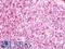 Transcription factor PU.1 antibody, LS-C317497, Lifespan Biosciences, Immunohistochemistry paraffin image 