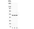 C-X-C Motif Chemokine Receptor 6 antibody, R31193, NSJ Bioreagents, Western Blot image 