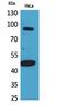 Inhibin Subunit Beta B antibody, PA5-51112, Invitrogen Antibodies, Western Blot image 