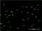 Forkhead Box C2 antibody, H00002303-M16, Novus Biologicals, Immunocytochemistry image 