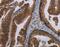 MAGE Family Member B3 antibody, MBS2517973, MyBioSource, Immunohistochemistry paraffin image 