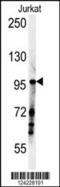 Sperm Associated Antigen 1 antibody, 62-012, ProSci, Western Blot image 