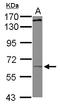 Kinesin Family Member 19 antibody, LS-C155579, Lifespan Biosciences, Western Blot image 