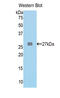 Fumarylacetoacetate Hydrolase antibody, LS-C302000, Lifespan Biosciences, Western Blot image 