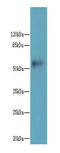 Glycosyltransferase Like Domain Containing 1 antibody, A65018-100, Epigentek, Western Blot image 