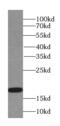 Thioredoxin reductase 3 intronic transcript 1 antibody, FNab08911, FineTest, Western Blot image 