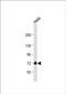 GUF1 Homolog, GTPase antibody, PA5-48469, Invitrogen Antibodies, Western Blot image 