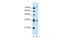 TMEM231 antibody, GTX46584, GeneTex, Western Blot image 