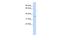 Visual System Homeobox 1 antibody, A04907, Boster Biological Technology, Western Blot image 