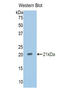 Serpin Family A Member 6 antibody, LS-C301961, Lifespan Biosciences, Western Blot image 