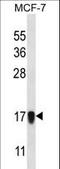 NADH:Ubiquinone Oxidoreductase Subunit A13 antibody, LS-C164798, Lifespan Biosciences, Western Blot image 