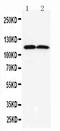 Anoctamin 1 antibody, PA2290, Boster Biological Technology, Western Blot image 