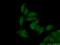 Snail Family Transcriptional Repressor 1 antibody, 26183-1-AP, Proteintech Group, Immunofluorescence image 