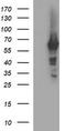 Tyrosine Hydroxylase antibody, CF506544, Origene, Western Blot image 
