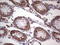Galectin 3 antibody, LS-C339235, Lifespan Biosciences, Immunohistochemistry paraffin image 