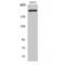 Integrin Subunit Beta 4 antibody, LS-C384146, Lifespan Biosciences, Western Blot image 