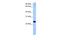 THRAP3P1 antibody, PA5-69744, Invitrogen Antibodies, Western Blot image 