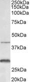 Actin Related Protein 2/3 Complex Subunit 1A antibody, 42-980, ProSci, Immunohistochemistry paraffin image 