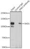 Staphylococcal Nuclease And Tudor Domain Containing 1 antibody, GTX33508, GeneTex, Immunoprecipitation image 