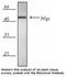 ST13 Hsp70 Interacting Protein antibody, NB120-13490, Novus Biologicals, Western Blot image 