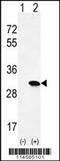 HRas Proto-Oncogene, GTPase antibody, MBS9209161, MyBioSource, Western Blot image 