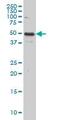 Interleukin 13 Receptor Subunit Alpha 2 antibody, ab55275, Abcam, Western Blot image 