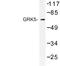 G Protein-Coupled Receptor Kinase 5 antibody, LS-C176749, Lifespan Biosciences, Western Blot image 