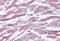 AKT Serine/Threonine Kinase 3 antibody, MBS243055, MyBioSource, Immunohistochemistry frozen image 