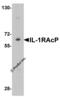Interleukin 1 Receptor Accessory Protein antibody, 2131, ProSci Inc, Western Blot image 