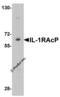 Interleukin-1 receptor accessory protein antibody, 2131, ProSci Inc, Western Blot image 