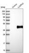 Interleukin 22 Receptor Subunit Alpha 2 antibody, PA5-56511, Invitrogen Antibodies, Western Blot image 