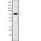 E3 ubiquitin-protein ligase RNF6 antibody, abx218330, Abbexa, Western Blot image 