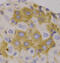 NBR1 Autophagy Cargo Receptor antibody, 19-224, ProSci, Immunohistochemistry paraffin image 