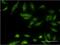 Ethanolamine kinase 1 antibody, MA5-22149, Invitrogen Antibodies, Immunofluorescence image 