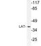 Linker For Activation Of T Cells antibody, LS-C177789, Lifespan Biosciences, Western Blot image 