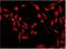 Cyclin Dependent Kinase 6 antibody, ab124821, Abcam, Immunofluorescence image 