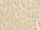 Ketohexokinase antibody, LS-C675942, Lifespan Biosciences, Immunohistochemistry paraffin image 