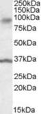 Ankyrin repeat and protein kinase domain-containing protein 1 antibody, NBP1-28459, Novus Biologicals, Western Blot image 