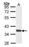 Cyclin Dependent Kinase 6 antibody, PA5-27978, Invitrogen Antibodies, Western Blot image 