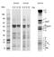 ATP Synthase F1 Subunit Alpha antibody, 45-7425, Invitrogen Antibodies, Immunoprecipitation image 