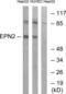 Epsin 2 antibody, LS-C119960, Lifespan Biosciences, Western Blot image 